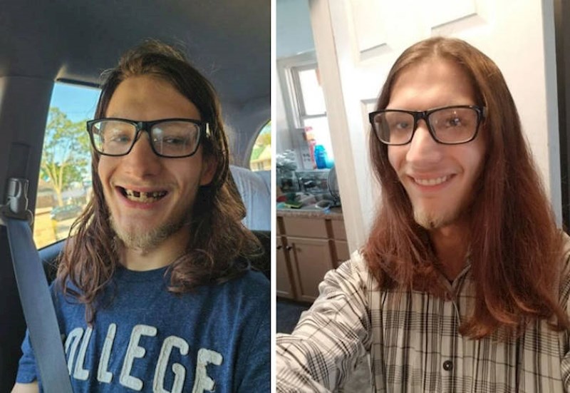 8. Napokon je odlučio popraviti zube i oduševio sve!