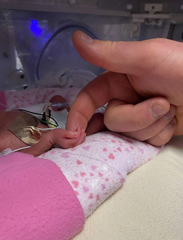2. "Naša kćerka rođena je prerano, sa samo 27 tjedana. Svaki dan ju dođem dotaknuti..."