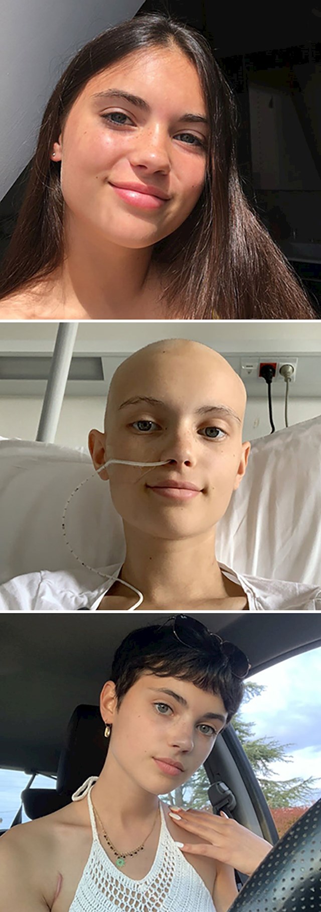 5. Prije i tijekom bolesti te nakon što je pobijedila rak! 👏🏼