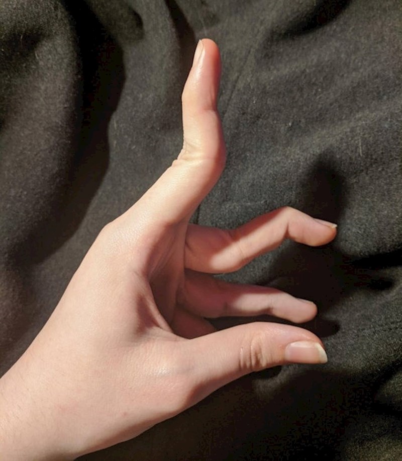 2. Ekstremno savitljiv prst