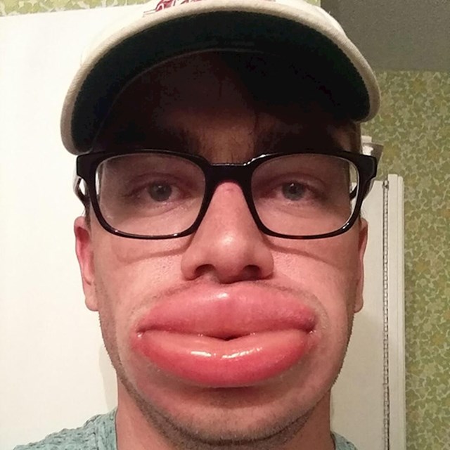 13.