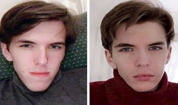 17 ljudi podijelili su fotke prije i poslije estetske operacije, rezultati su zapanjujući