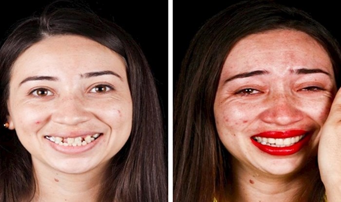 Brazilski stomatolog putuje svijetom i sasvim besplatno vraća osmjeh na lica siromašnih ljudi