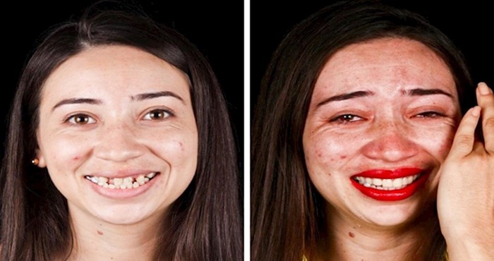 Brazilski stomatolog putuje svijetom i sasvim besplatno vraća osmjeh na lica siromašnih ljudi
