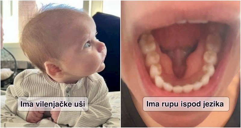 15 ljudi pokazalo je svoja rijetka fizička obilježja koja gotovo nitko drugi nema