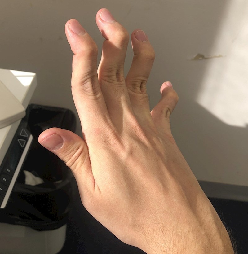 8. Ekstremno savitljivi prsti