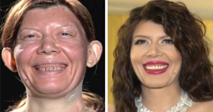17 žena pokazale su svoje ekstremne transformacije, od većine će vam ispasti vilica na pod