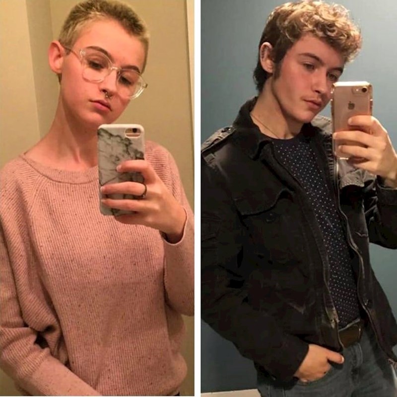 8. "Nakon dvije i pol godine hormonske terapije i 7 mjeseci nakon operacije grudi."