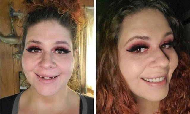 2. Godinama sam ignorirala svoje mentalno i dentalno zdravlje. Napokon sam se odlučila sabrati i poraditi na sebi, emocionalno i fizički.