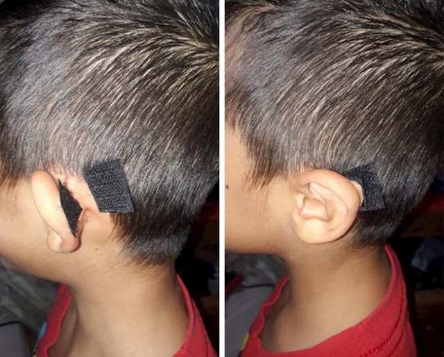 4. "Moj nećaka su u školi zezali da ima klempave uši. Evo kako smo riješili problem!"