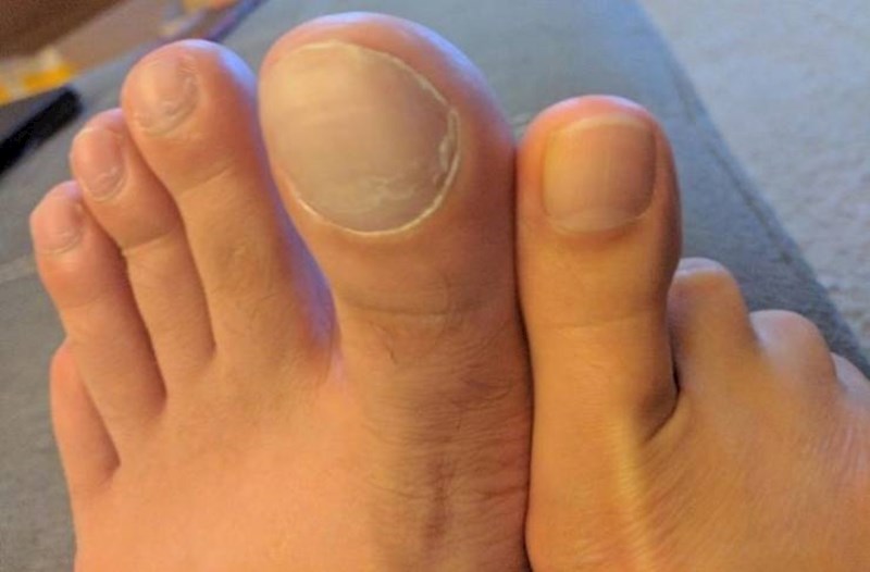 15. "Moj nožni prst i nožni prst moje žene"