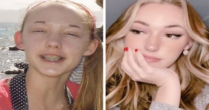 20 primjera drastičnih transformacija koje će vas zadiviti