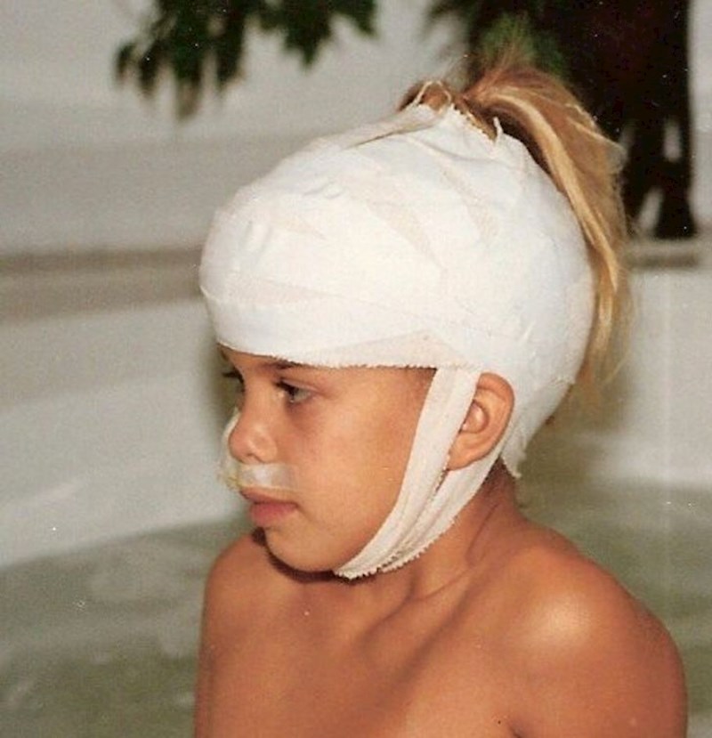 5. Mama joj je izbušila rupu u gipsu za repić, jer se brinula da nitko neće znati da je djevojčica