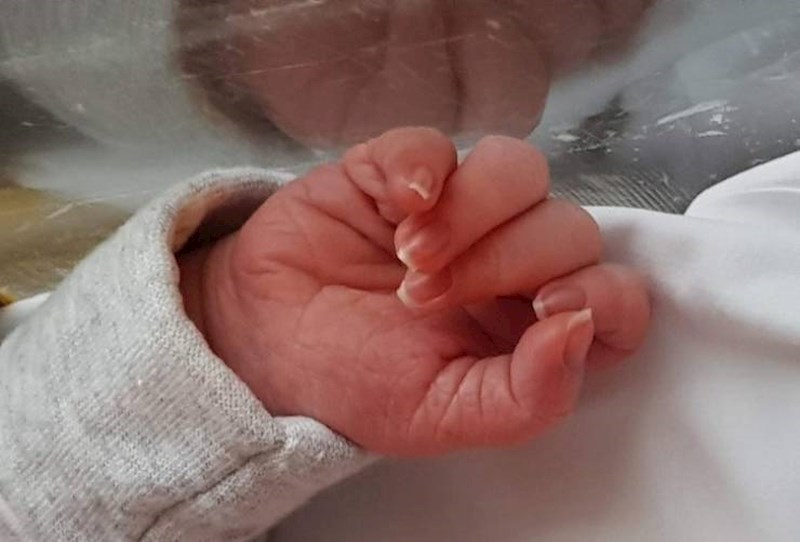 Djevojčica koja je rođena s francuskom manikurom.