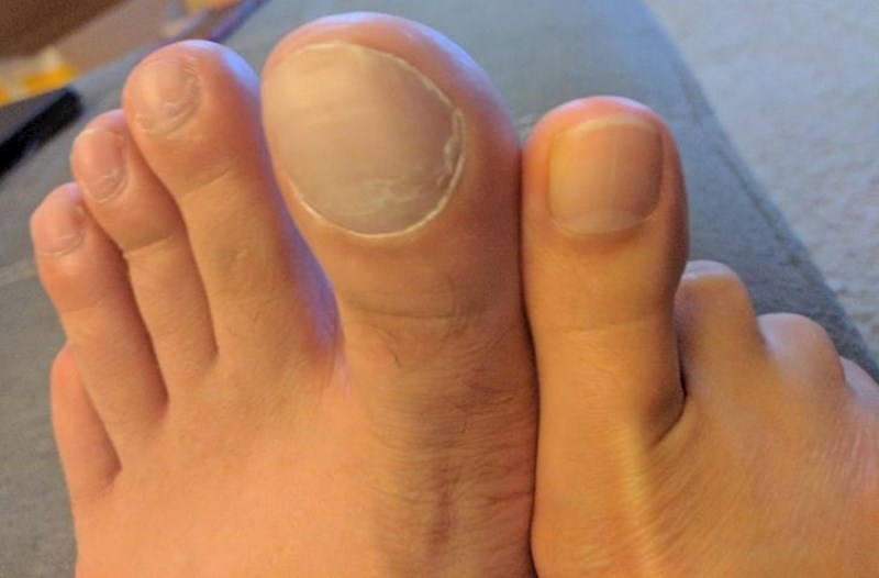 "Žena i ja usporedili smo nožne palčeve."