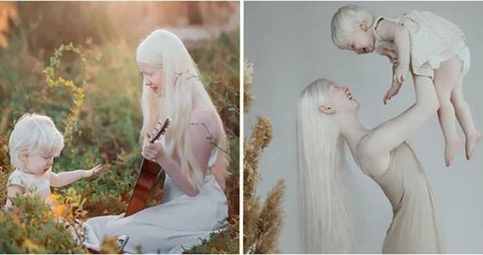 Jedinstvene albino sestre iz Kazahstana zadivile svijet svojom ljepotom