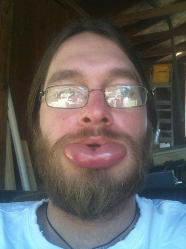 10.