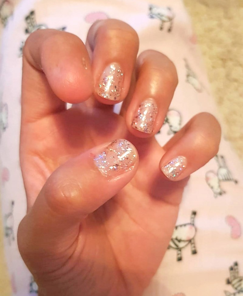 2. Rođena je bez jednog nokta