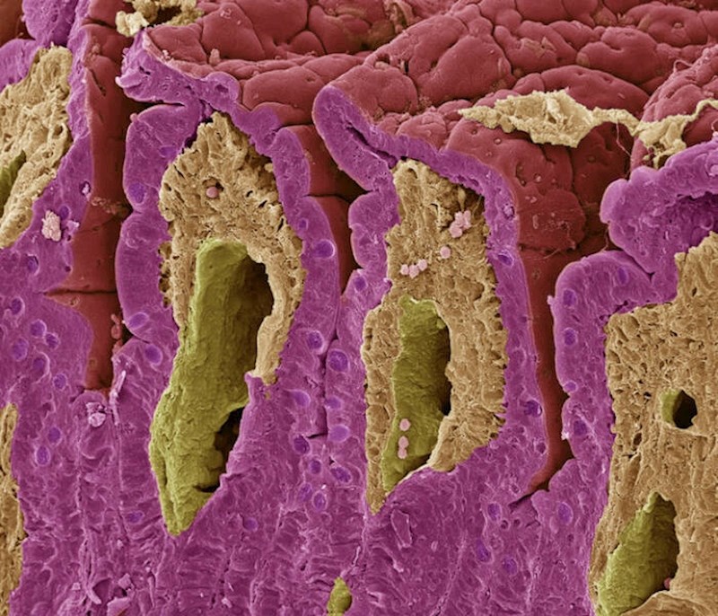 14. Crijevna sluznica