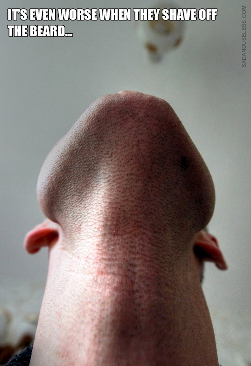 A još je i gore kad obriju obradu...:0