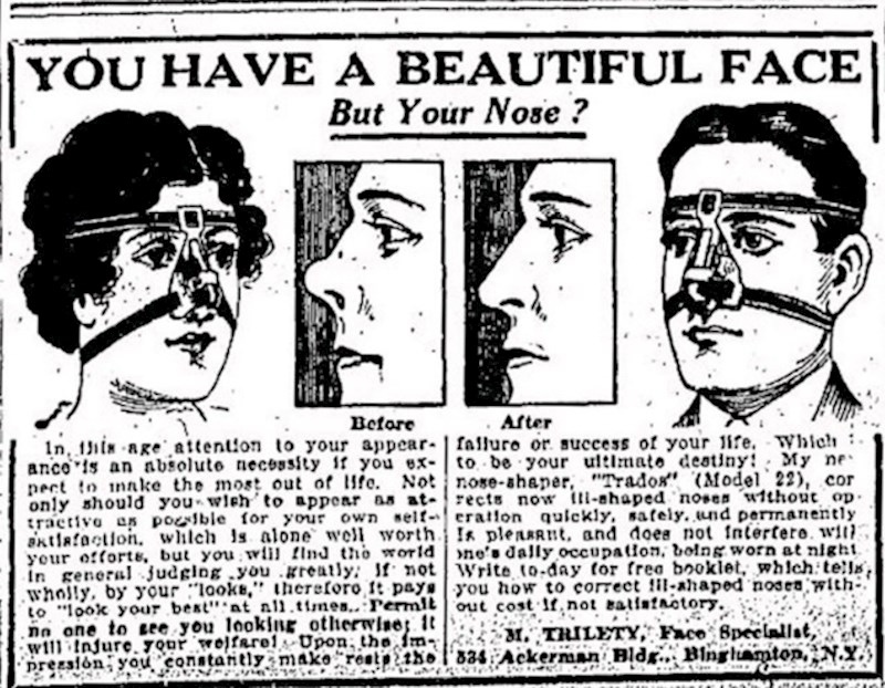 15. Operacija nosa u prošlosti i danas.