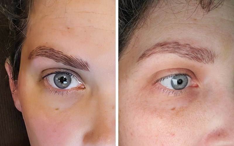 10. Užasno napravljeno iscrtavanje obrva i situacija nakon uklanjanja.