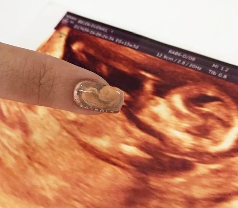 23. Novi bizaran trend - ultrazvuk nokti