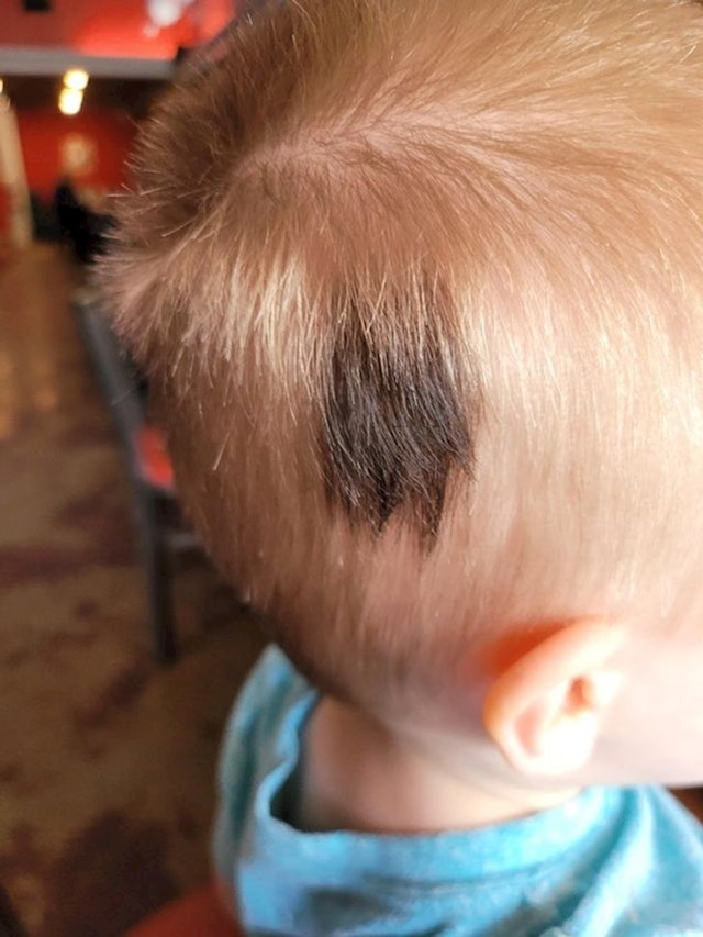 15. Rođen je s ovom crnom točkom usred svoje plave kose. Nije madež, samo diskoloracija.