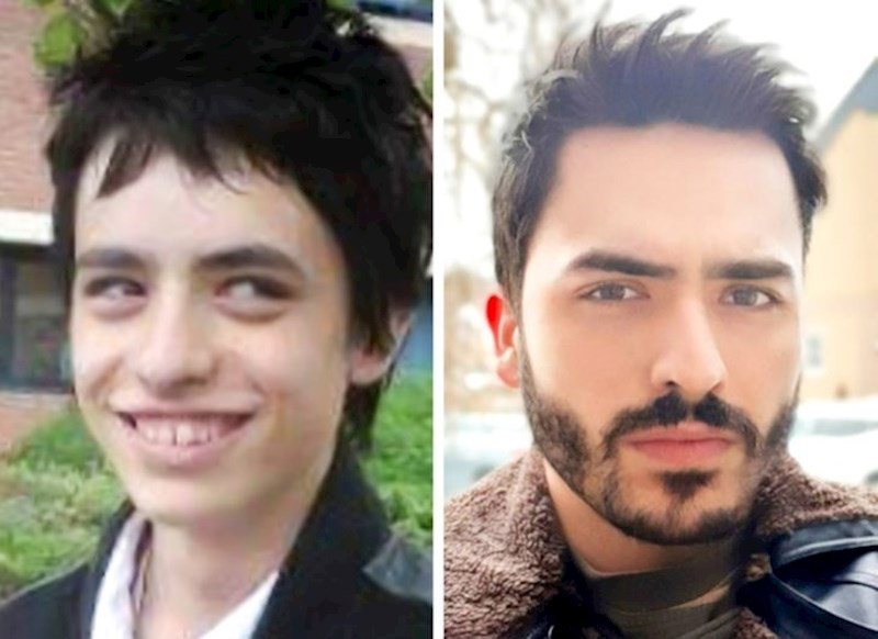 6. Ovaj 17-godišnjak s lijeve fotke se pretvorio u pravog manekena 10 godina kasnije.🤩