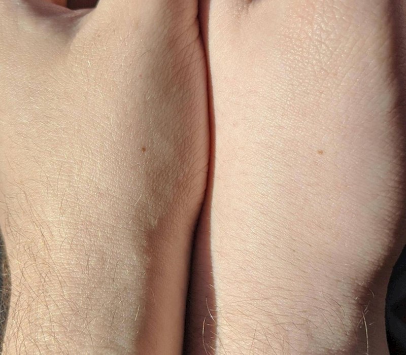 12. "Moj dečko i ja imamo madež na istom mjestu."