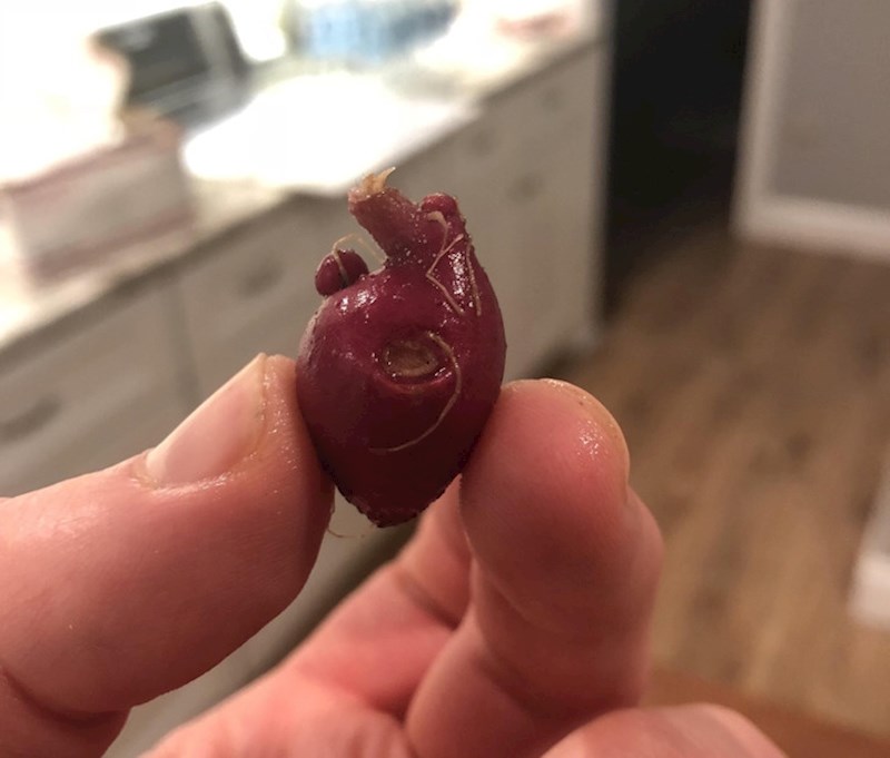 2. Batat koji izgleda kao ljudsko srce