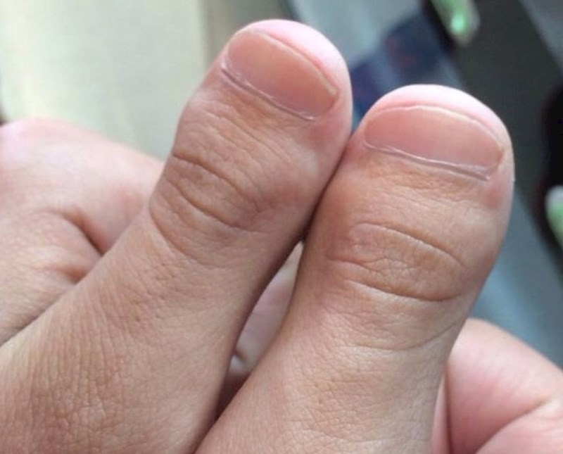 8. "Svi mi kažu da imam nožne prste na rukama"