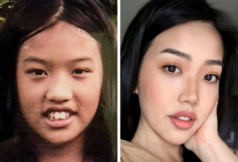 1. Koliko se promijenila od puberteta...😱