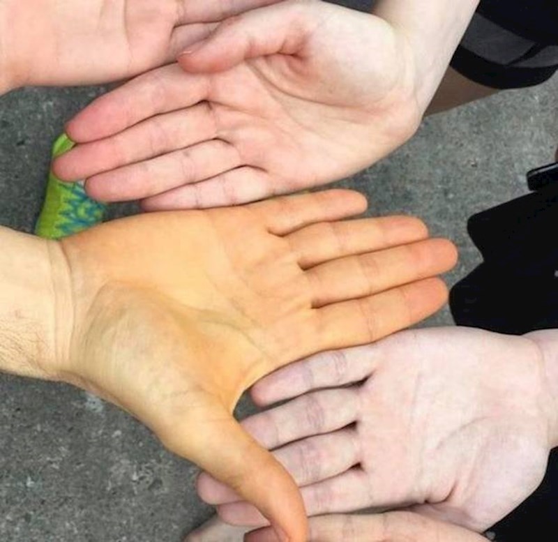 7. "Naš tata svaki dan pojede mrkvu. Razlika u koži je očita..."