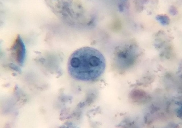9. "Ovo je ameba koju sam ugledao kroz mikroskop."