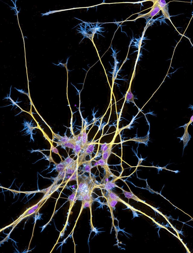 5. Neuroni iz matičnih stanica