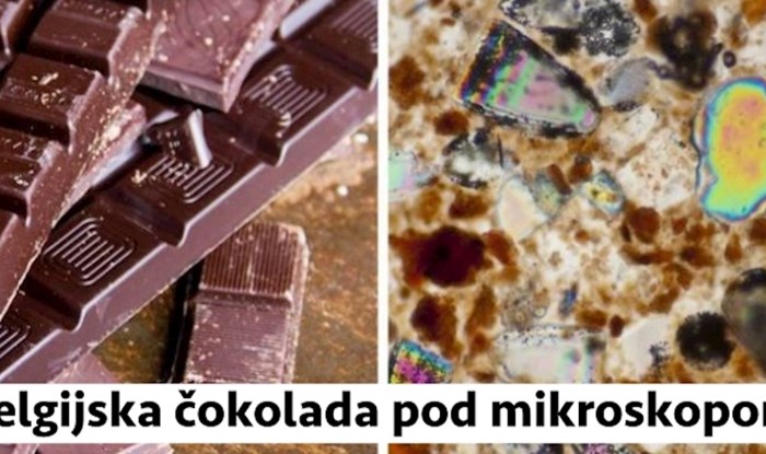 Evo kako 14 stvari koje svakodnevno viđamo izgledaju pod mikroskopom