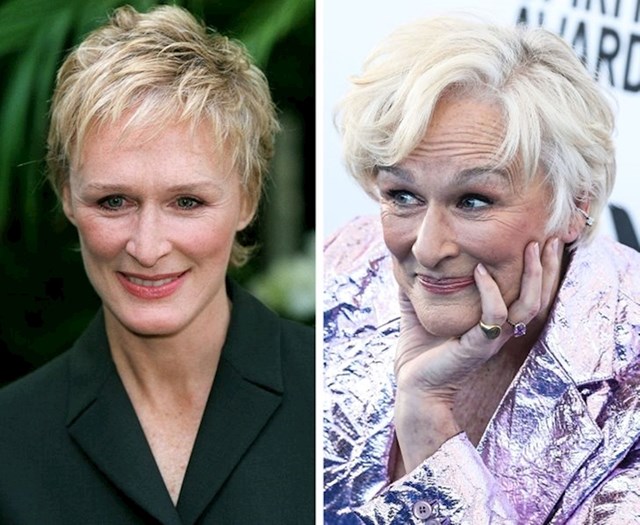 14. Glenn Close