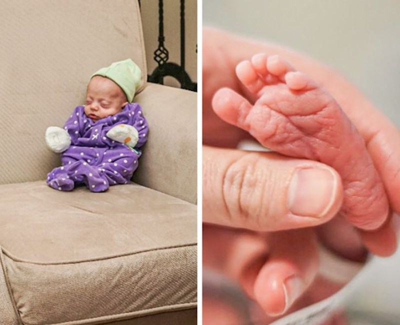 17. Mala beba koja je toliko sićušna da izgleda kao kućni vilenjak