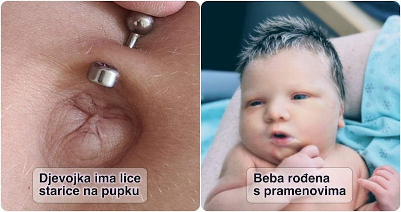 15 ljudi i životinja koji zbog jedinstvenih karakteristika izgledaju kao da su začarani