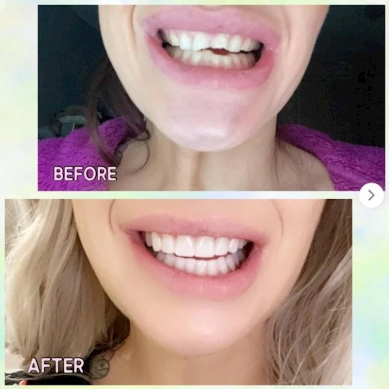 8. Djevojka prije i nakon posjeta zubaru