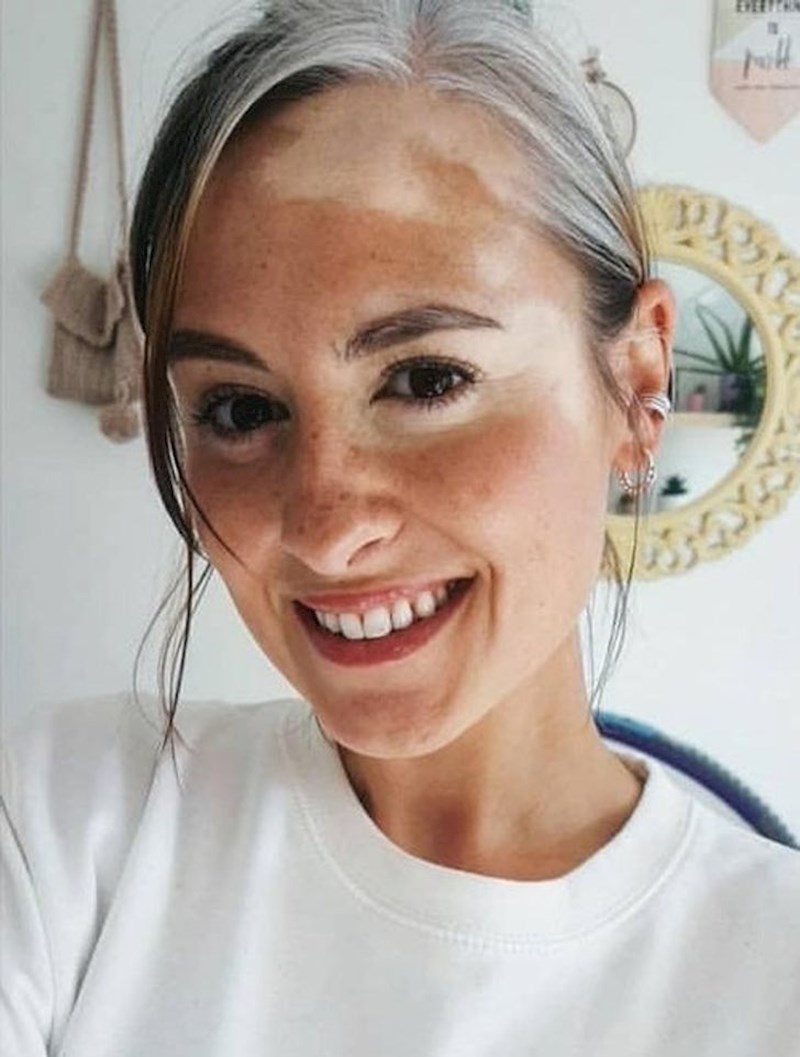 4. "Prihvatila sam svoje nesavršenosti"