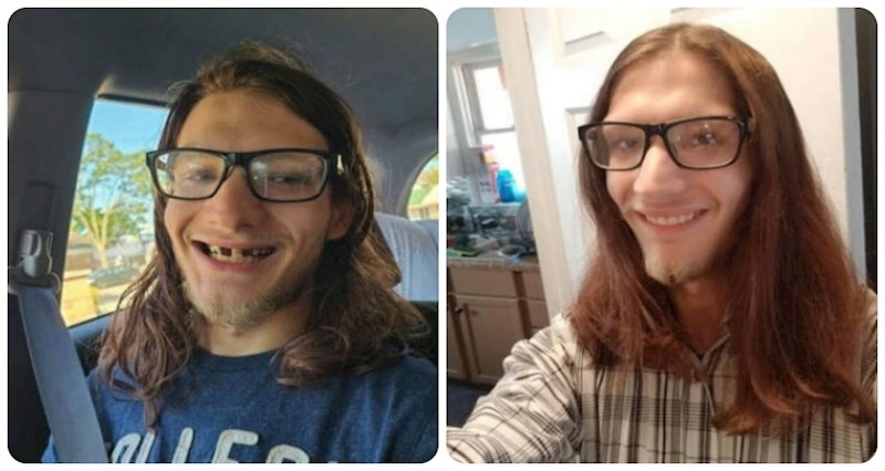 15 ljudi podijelilo je različite usporedne fotke koje dugo nećete moći zaboraviti