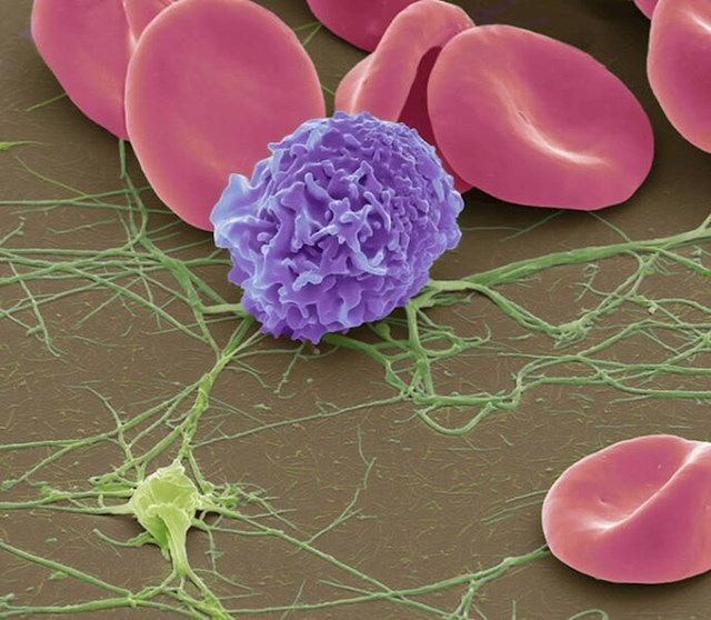 12. Crvena krvna zrnca, jedna bijela krvna stanica i trombocit (zeleni) s fibrinskim nitima