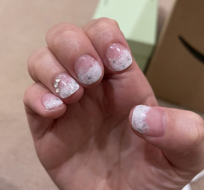 Manikura za koju bi trebalo tražiti naknadu štete