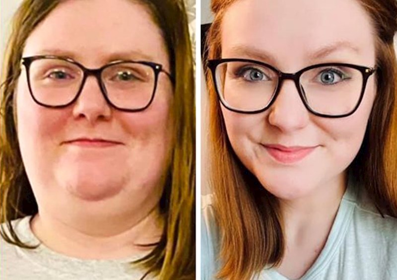 10. "Smršavila sam i promjena se najviše vidi na mome licu!"