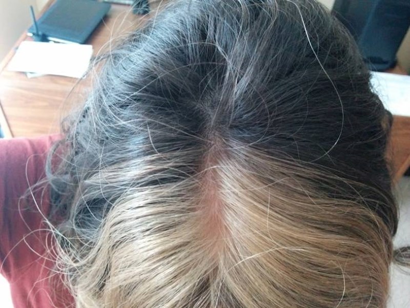 Ova osoba je prirodno pola plavuša, pola brineta.