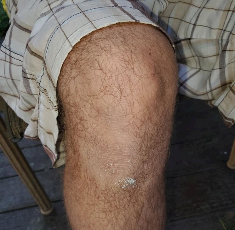 4. Cijeli život postavlja parkete, što se i vidi na njegovim koljenima