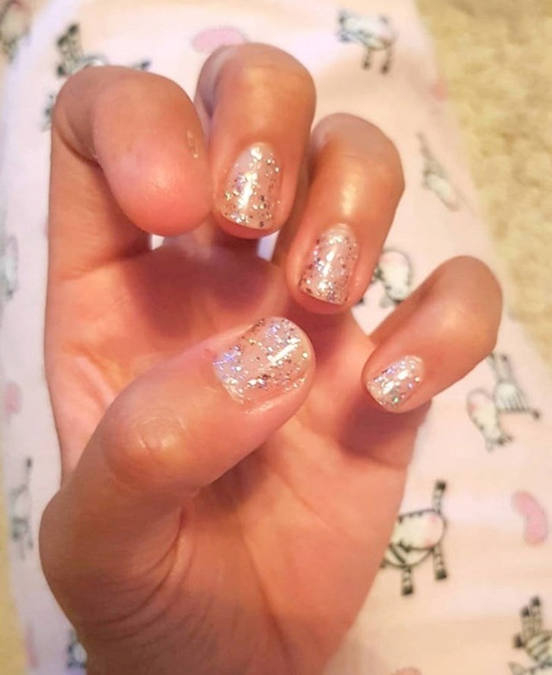 5. "Moja cura rođena je bez jednog nokta."