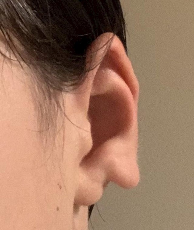 5. Nesvakidašnje uho